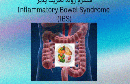 سندرم روده تحریک پذیر (IBS)